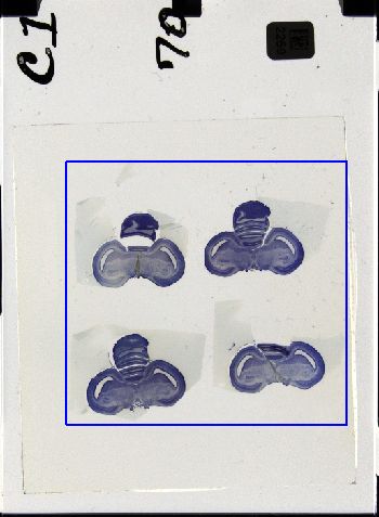Media type: image; Special Collections 3298   shows specimen_part histological serial section;